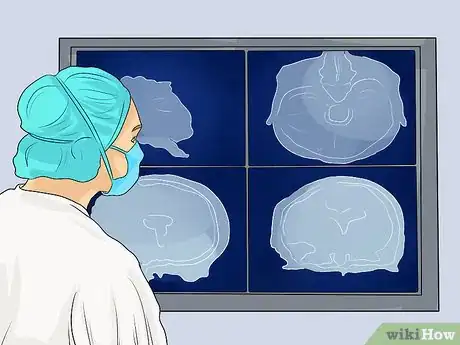 Image titled Act Immediately to Lessen Brain Damage from a Stroke Step 2