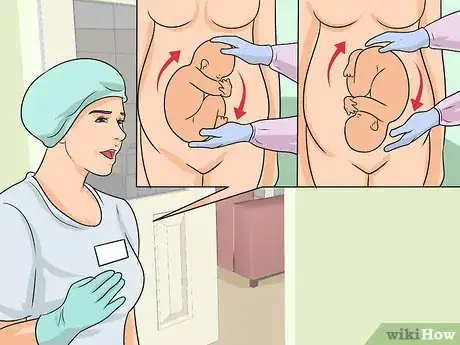 Image titled Avoid a Cesarean Section Step 12