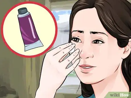 Image titled Remove Ingrown Hair on Your Face Step 6