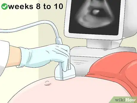 Image titled Calculate Your Due Date Step 9